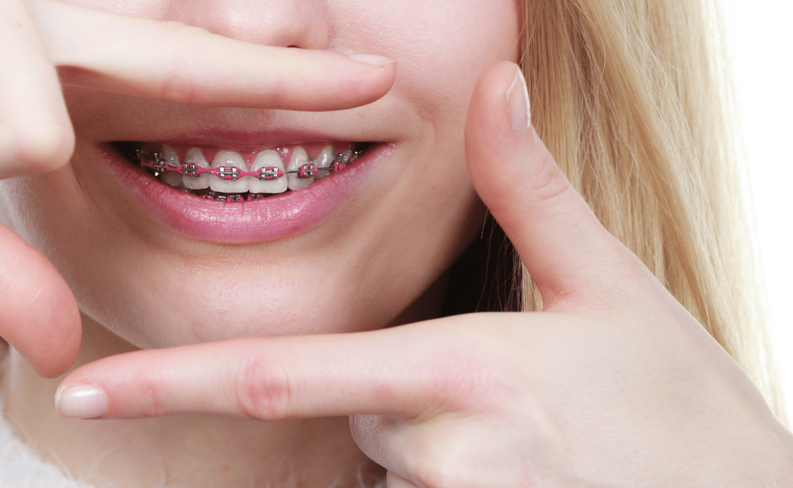Ortodontia GrandoSmile Grândola Dentista