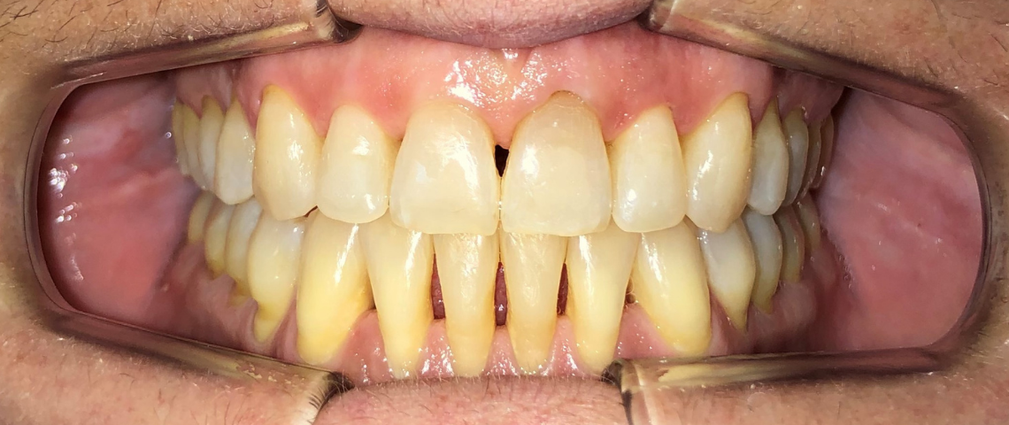 Depois Dentista Ortodontia